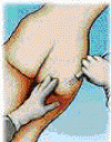 liposuccion-2.gif